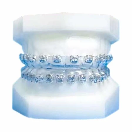 Orthodontic Brackets úr málmi